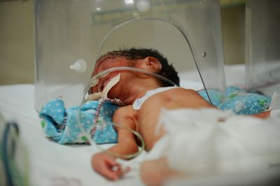 Infant Breathing Hoses Flagged by the FDA After Manufacturer Confirms Cracks That Can Restrict a Baby's Air