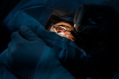 Surgeons Repairing a Diabetic Woman's Retina Found Two Live Worms Tucked Behind Her Eyelids
