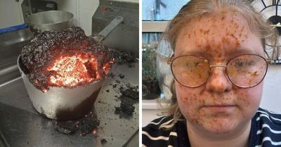 People Had Such Tragic Kitchen Fails That They Had To Take Pictures And Here Are 73 Of Them