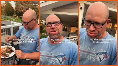 Man’s lips start swelling after a bee gets into his beer: ‘How do we prove it’s not AI?’