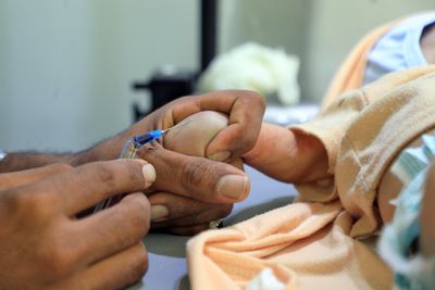 Six-Week-Old Infant Confirmed to Have Died of Measles as U.S. Cases Reach 3,134