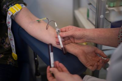 A Blood Test, Not a Scan, Now Triggers This Breast Cancer Treatment Switch Under Accelerated Approval