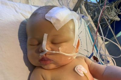 Mother tells how nail infection led to diagnosis of baby son’s brain tumour