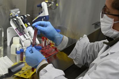 A COVID Study of Twelve Women Points to the Same Immune Cells Seen in Lupus Patients
