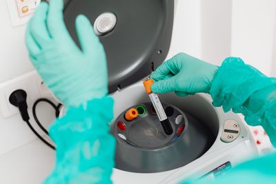 Two Routine Tests Could Catch Kidney Damage Early in Heart Patients Under New European Cardiology Guidelines