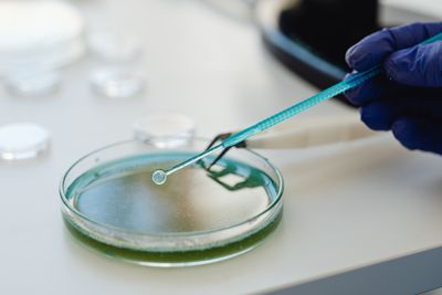 A Bacterium in the Urinary Tract Can Produce Testosterone and Prostate Cancer Researchers Are Paying Attention