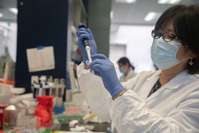 Autoantibodies That Appear After COVID Infection Trace Back to an Immune Cell Subtype Also Linked to Lupus