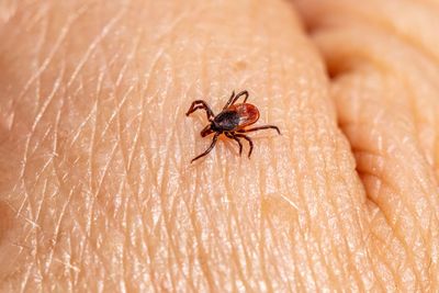 A Rare Lyme Bacterium Turned Up in Herkimer County Ticks and a Resident Who Never Left New York