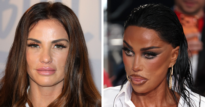 Katie Price Sparks Concern With Latest Appearance After Having Corrective Surgery
