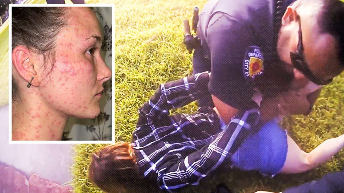 Appeals Court Grants Immunity to Texas Cops Who Held Handcuffed Woman Face Down in a Fire Ant Hill