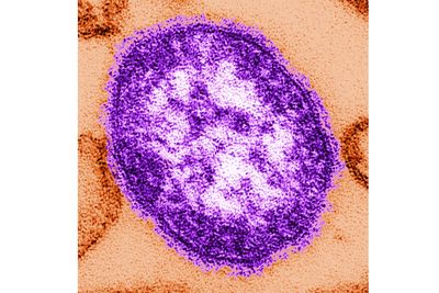 Coroner releases details of infants who died amid growing Pennsylvania measles outbreak