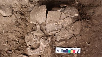 Ancient teeth show drugs used earlier than thought