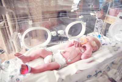Postmortem Reviews Found Four in Five Stillbirths and Child Deaths in Africa and South Asia Were Potentially Preventable