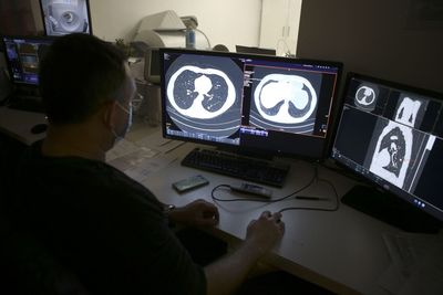 Lung Cancer Patients With HER2 Mutations Can Now Start a Daily Targeted Pill Before Any Other Systemic Treatment