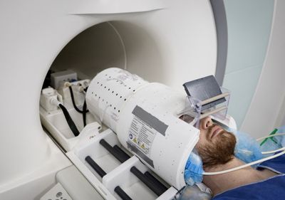 An 8.3-Centimeter Mass in a 19-Year-Old's Brain Looked Like Aggressive Cancer but Was a Rare Benign Lesion Packed with Calcium