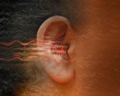 Living with tinnitus can be distressing. So what can you do about it?