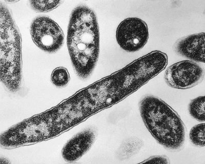Legionnaires’ disease outbreak kills one and infects others in the South Bronx