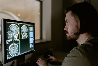 Voices in Her Head Sent Her for a Brain Scan, and Surgeons Found a Tumor No Doctor Had Suspected