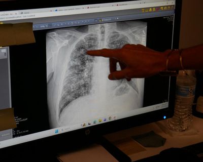 We know how to prevent black lung, so why are workers still dying?