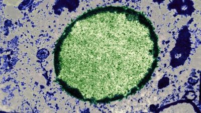 Pennsylvania has its third measles-related death reportedly amid outbreak, and this time it claims the life of a 40-year-old woman