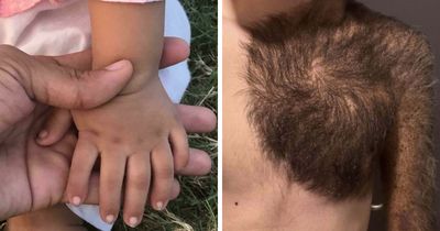 “40 Years Of Hiding These”: 85 Rare And Unexpected Body Quirks That Left People Fascinated