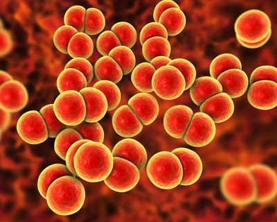 Gonorrhoea and syphilis rise by more than 50% in Australia with ‘concerning’ rise in cases in women