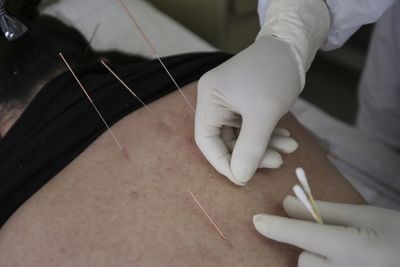 Needle Treatments Rarely Puncture the Lung, but the Warning Signs Can Take Days to Appear