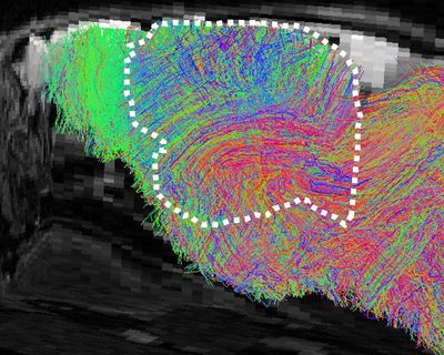 Scientists create mice with part-human brains