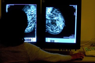 Breast cancer: Women in their 30s and 40s ‘should be warned of alcohol risk’