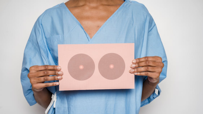 NHS Trust Admits 20 Women Had Unnecessary Mastectomies After Breast Cancer Failures