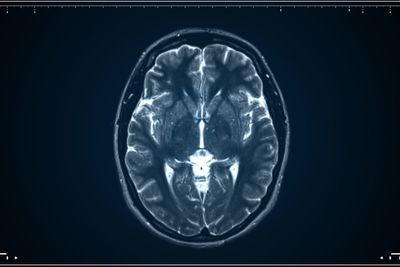 Human brain is actually two separate organs, scientists find