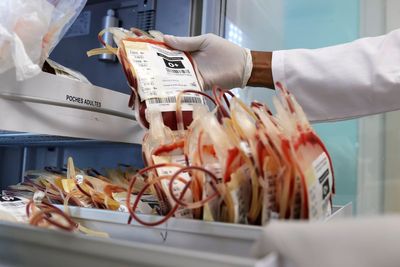 West African scientists warn of weakening health systems and urge stronger outbreak detection
