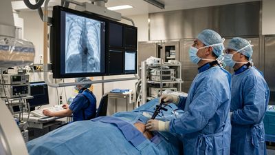 Cardiologists Couldn't Push a New Heart Valve into Place Until They Lassoed Its Delivery System Like a Cowboy