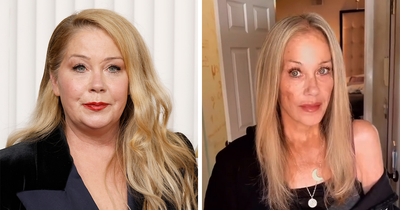 Christina Applegate Sparks Fresh Concern After Appearing In First Photos Since Four-Month Hospital Stay