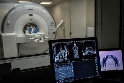 Brain Scans of 24 Long COVID Patients Show a Lower Dopamine Marker Tied to Fatigue and Memory Problems