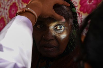 She Saw a Live Worm Moving Under Her Eye in the Mirror, Four Years After Leaving Nigeria