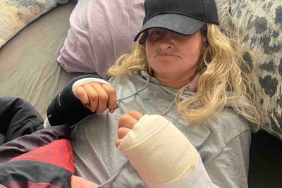 San Francisco woman who narrowly survived dog attack relives the horror: ‘kept hearing the crunching sound’