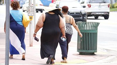 Obesity and overweight cost European economies billions of euros a year, industry says