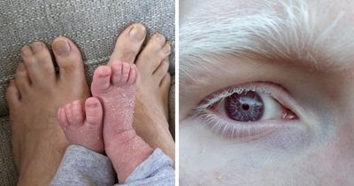 75 People Who Clearly Won The Genetic Lottery In The Most Unexpected Ways