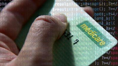 Warning Medicare breach is no excuse to burn AI bridges