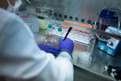 Only 3% of US sickle cell patients receive red blood cell exchange for disease, researchers find