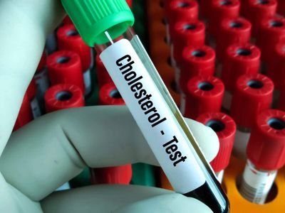 Sun Pharma signs major deal with LIB Therapeutics of US, gains access to $3.7-bn global market for bad cholesterol inhibitor PCSK9