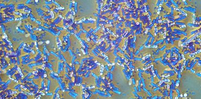 Hibernating bacteria can invade hospitals and survive outer space – but their high energy bill is a weakness that scientists can strike