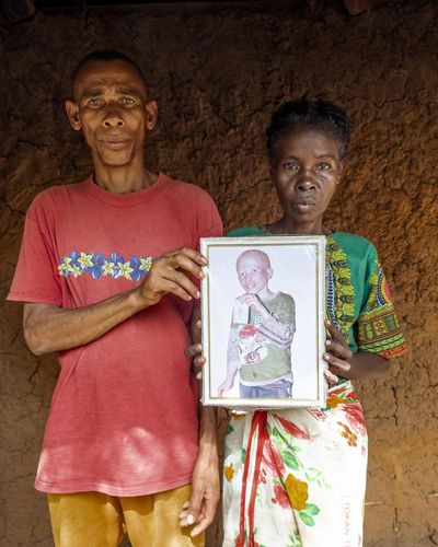 Murdered for their eyes: people with albinism living in terror in Madagascar