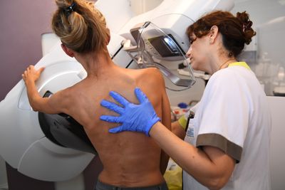 Women Weighing Mammograms Get New Evidence That Overdiagnosis Risk May Be Far Lower Than Earlier Estimates