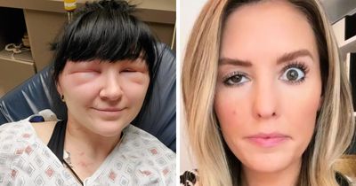 64 People Share The Beauty Procedures They Wish They Could Take Back