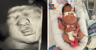 Pregnant Woman Goes For Routine Scan, Then Hears A Terrifying Two-Word Diagnosis
