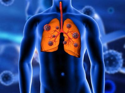 3 Warning Signs Your Lungs May Not Be Healthy