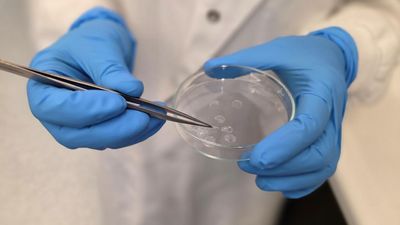 Synthetic bee silk set to take sting out of wounds