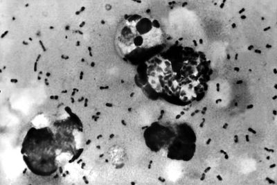What we know about suspected plague in Russia after lab worker dies